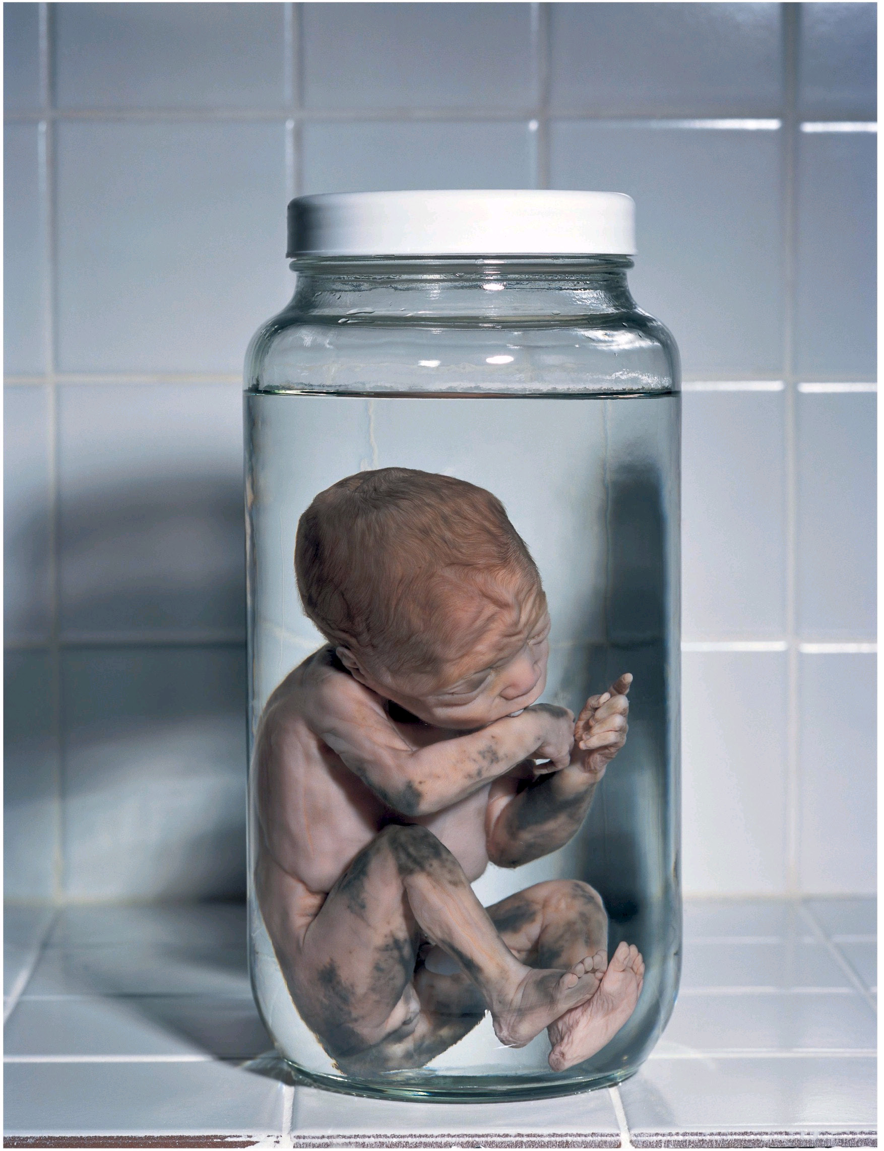 Brazil 2004 ETS baby - pregnant women, spontaneous abortion, graphic
